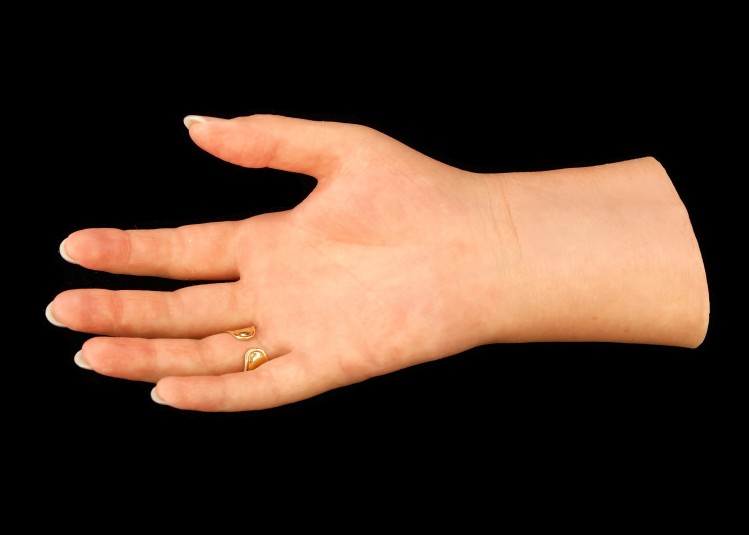 Palm side of right cosmetic hand, with gold ring visible.