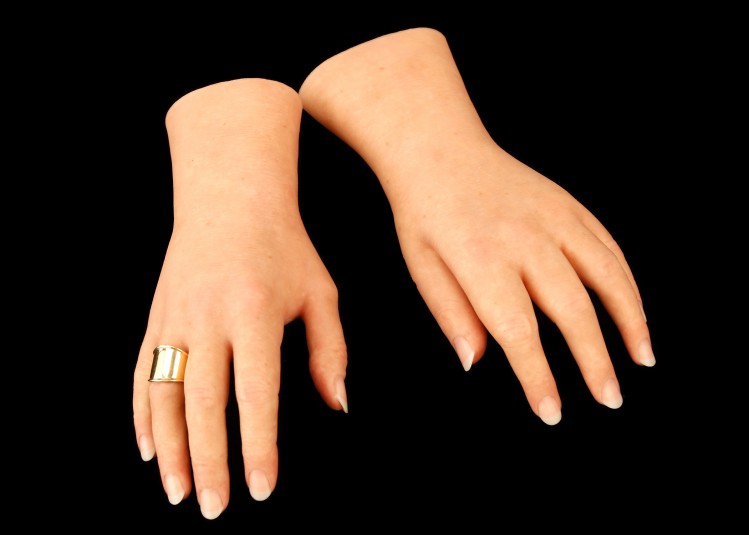 Top side (also called dorsal side) of the left and right cosmetic hands, with a gold ring on the right ring finger.