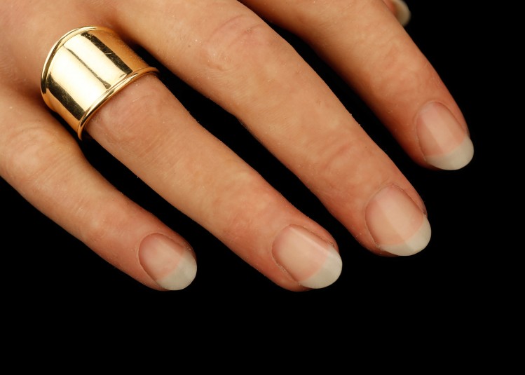 Close up of top side of right cosmetic hand, with view of fingernails and some fingers, including the one with the ring on it.