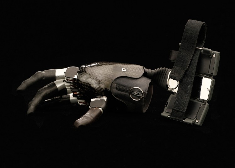 Cindy's black and silver, metal-and-chrome myoelectric hand, a fully prosthetic biomimetic hand with motorized fingers for gripping. The hand zips onto the residual arm and straps into place on the forearm with a large three-part buckle.
