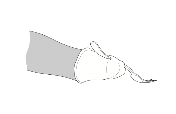 Black-and-white industrial design drawing of the fork/silicone unit on Cindy's hand. Her arm is visible in grey to the left, with the fork cap situated on the end of her arm.